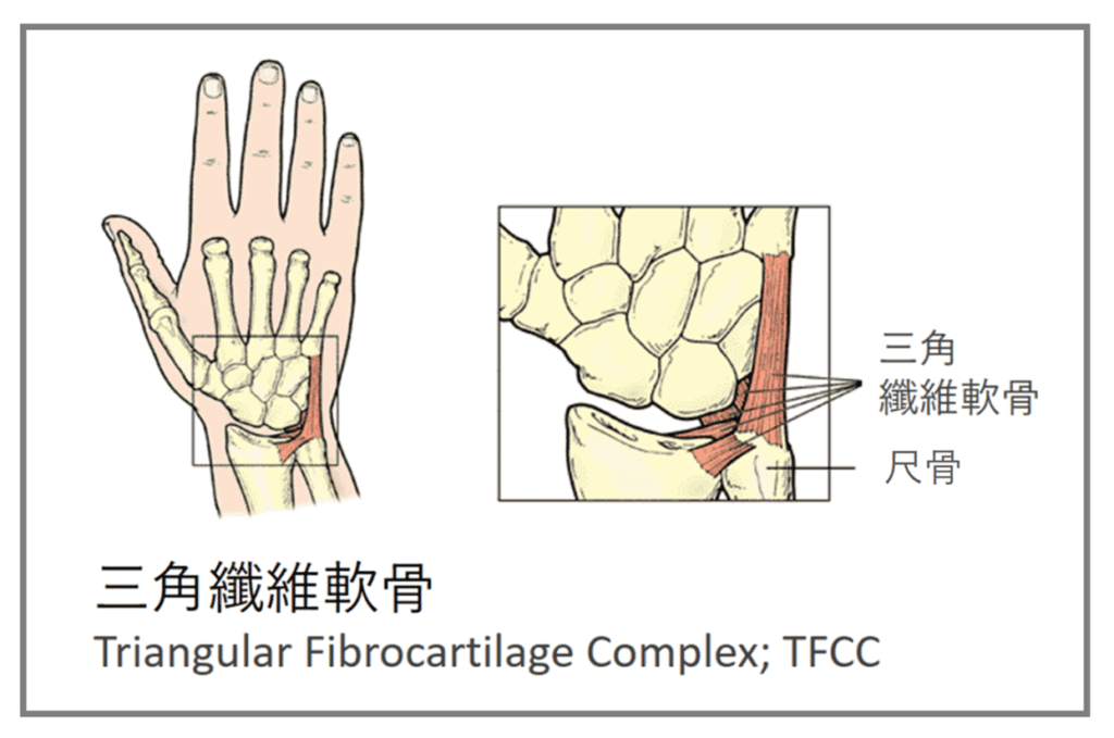 手腕外侧疼痛到底发生什麼事?